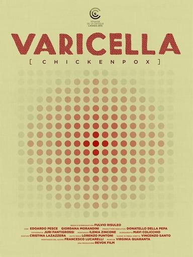 Varicella