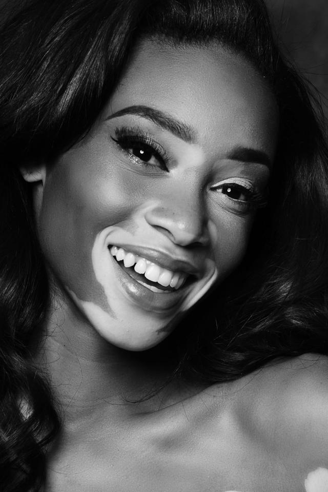 Profile Winnie Harlow